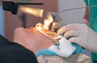 כמה עולה ניתוח לייזר בעיניים