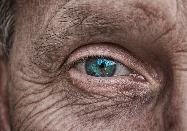 עין עצלה אצל מבוגרים